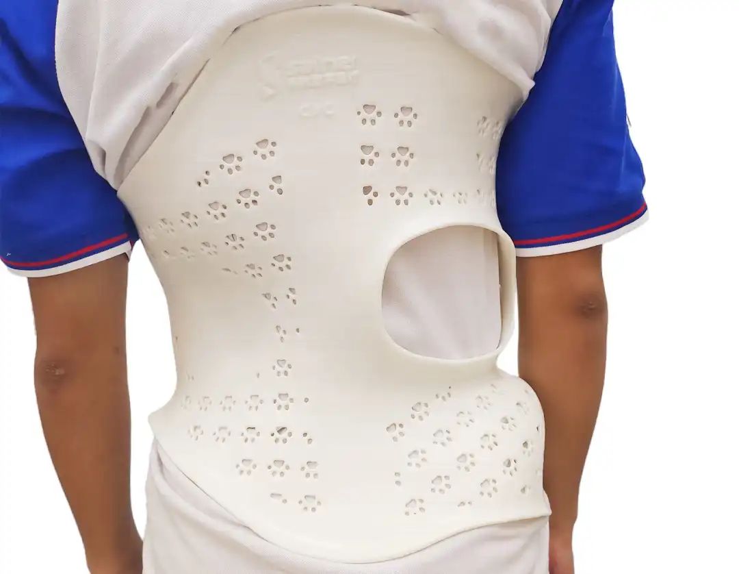 工業(yè)人|樹(shù)脂3D打印·醫(yī)療篇(圖6)